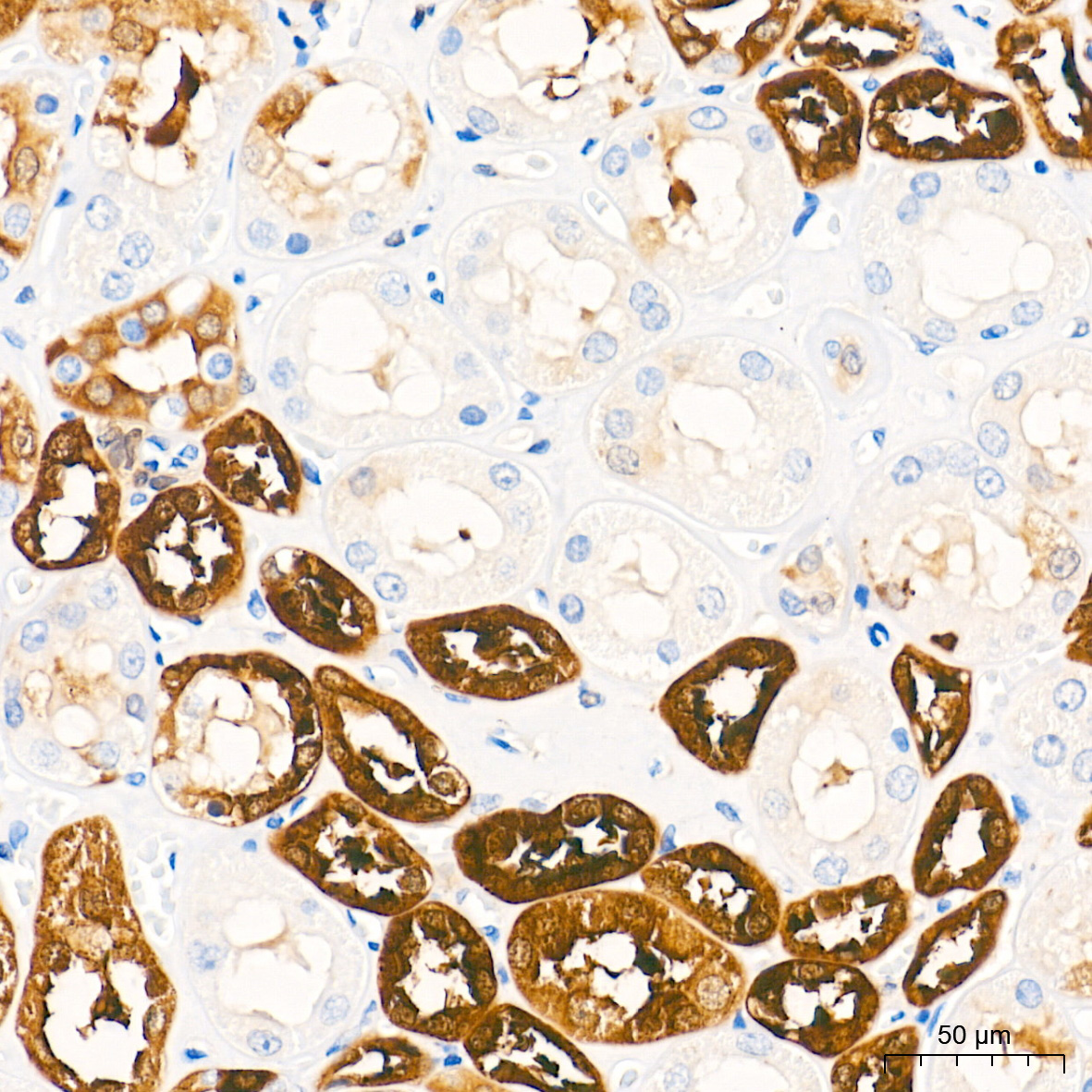PHGDH Rabbit mAb