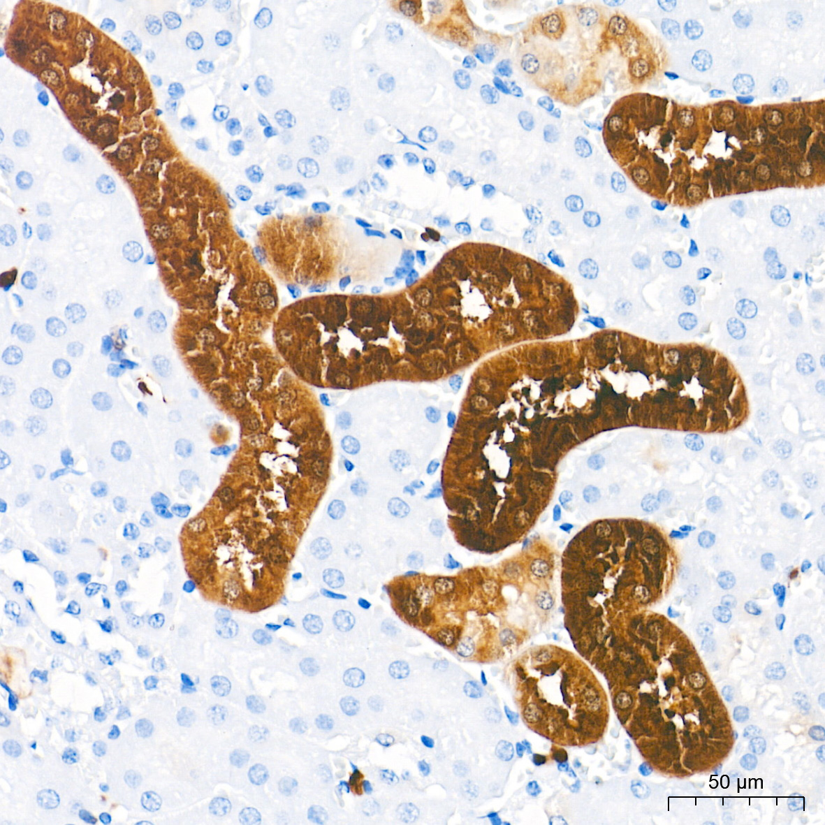PHGDH Rabbit mAb