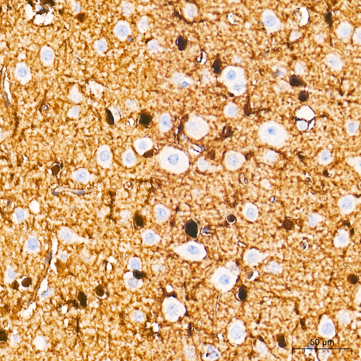 PHGDH Rabbit mAb