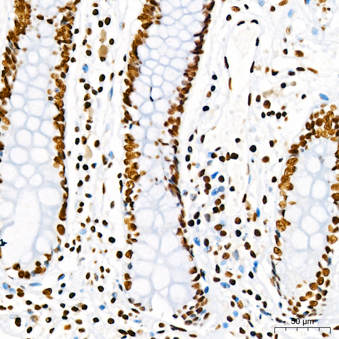 DiMethyl-Histone H3-K4 Rabbit mAb
