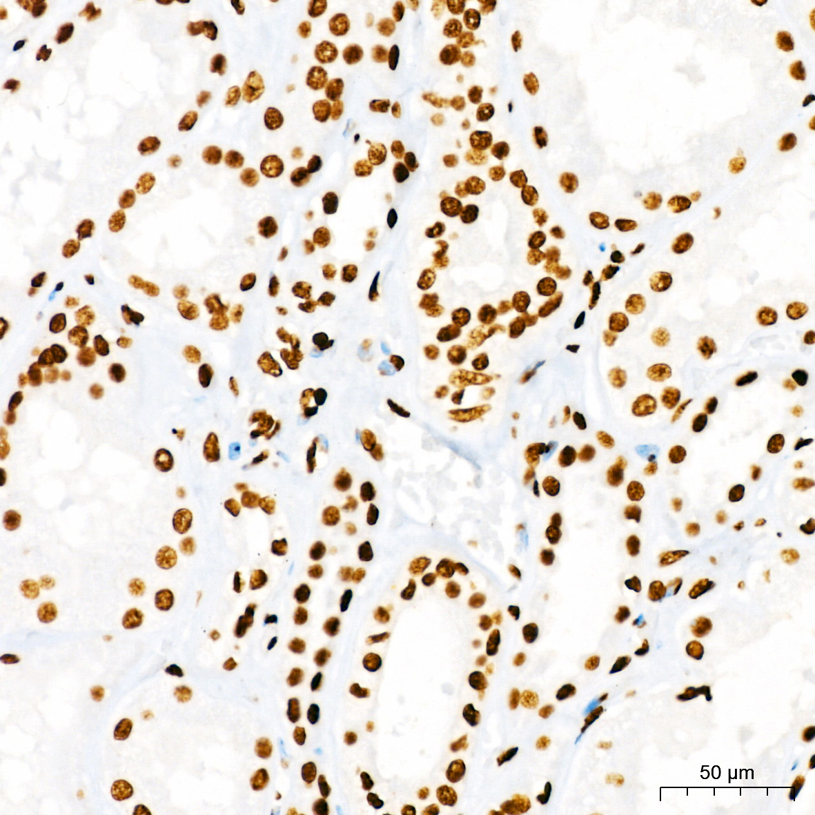 DiMethyl-Histone H3-K4 Rabbit mAb