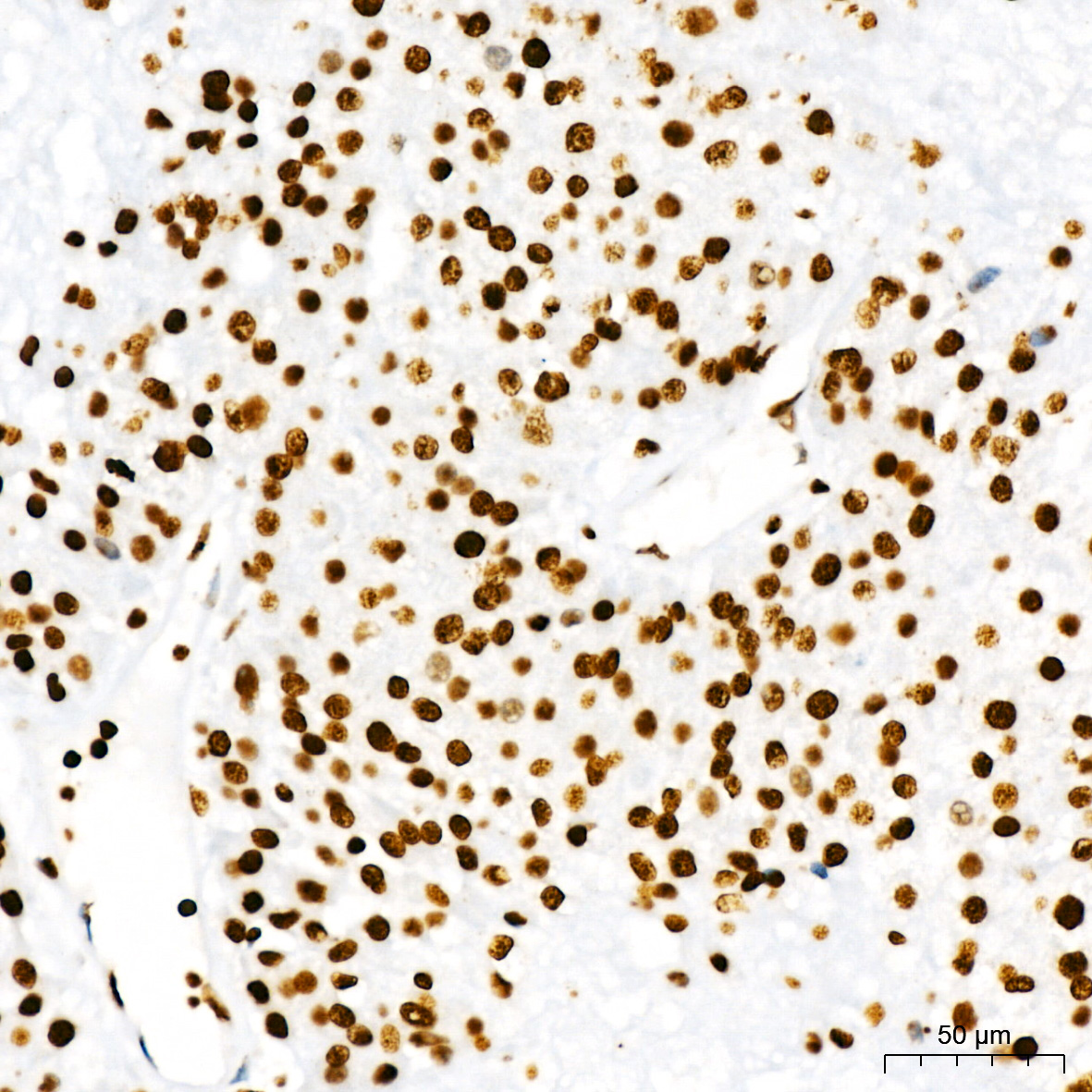 DiMethyl-Histone H3-K4 Rabbit mAb