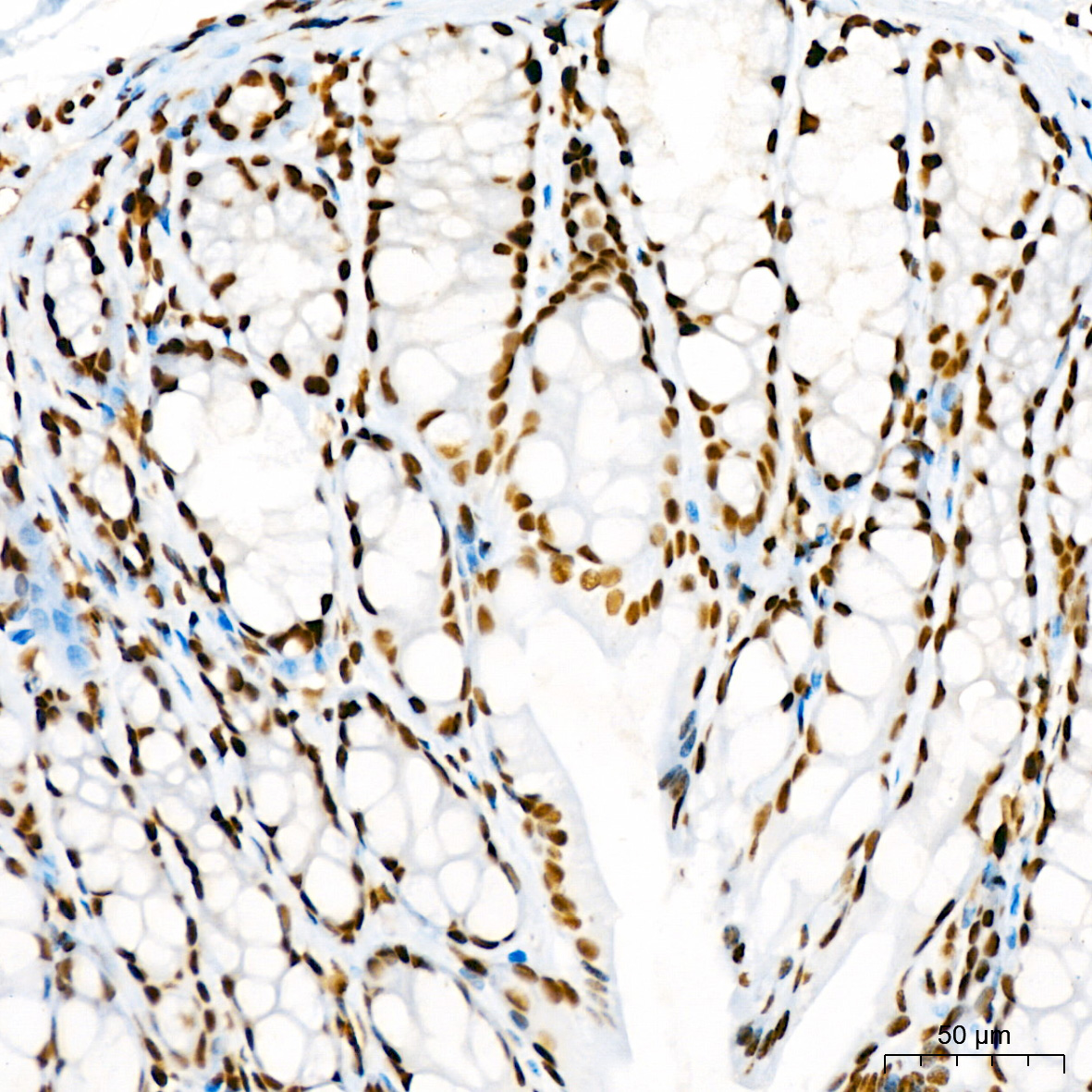DiMethyl-Histone H3-K4 Rabbit mAb