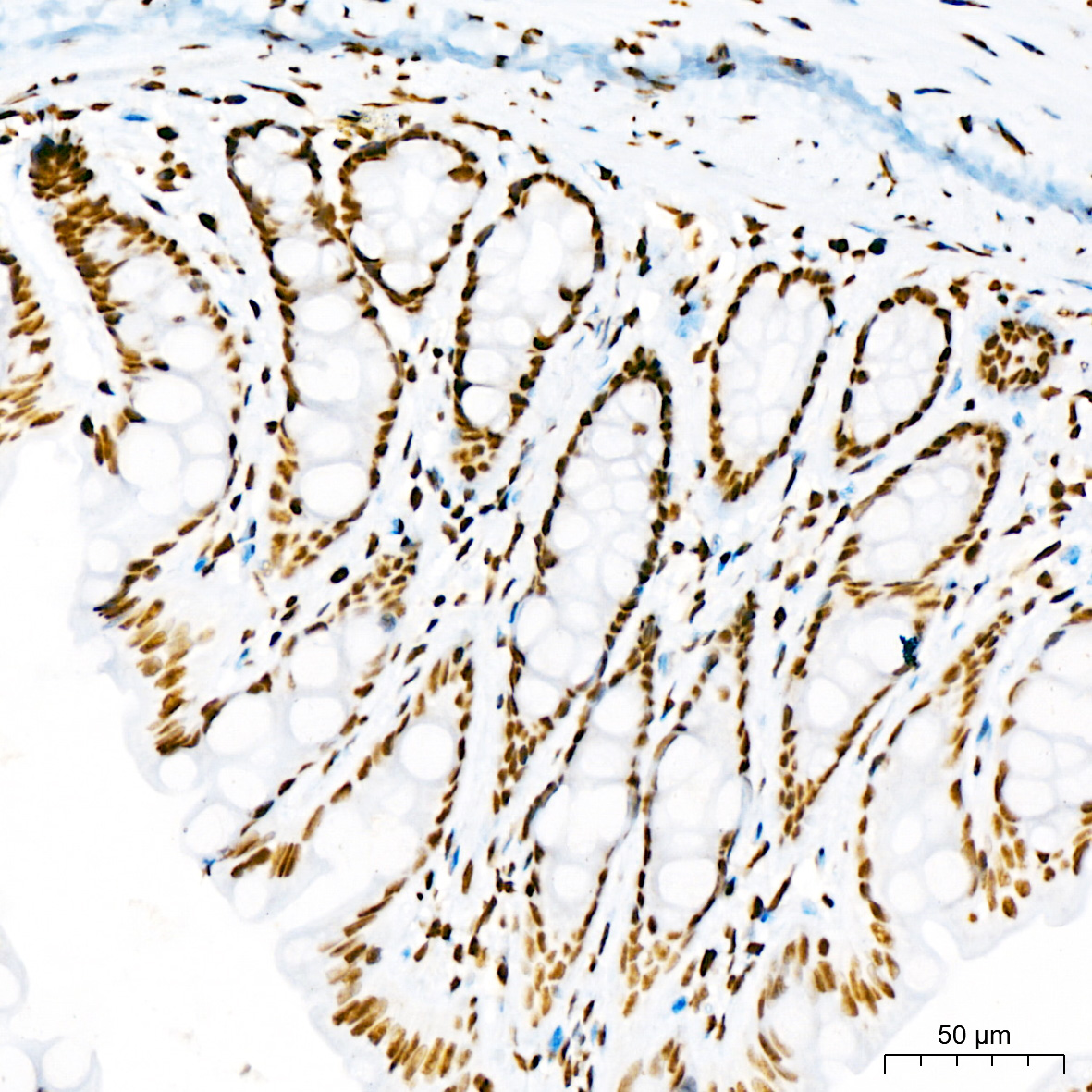 DiMethyl-Histone H3-K4 Rabbit mAb