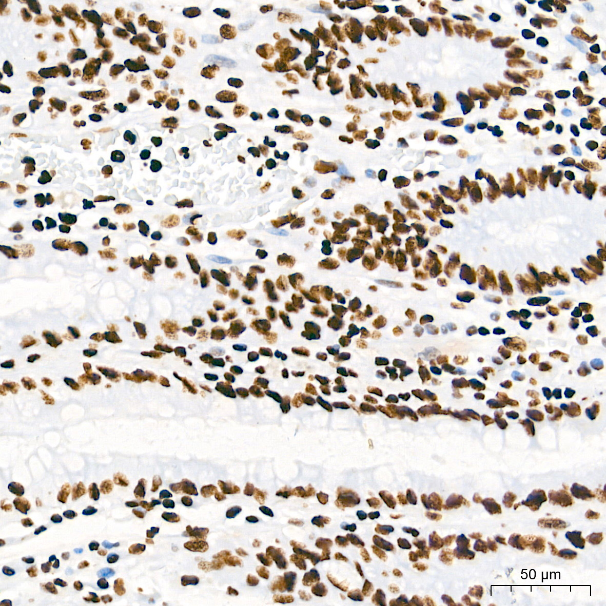 TriMethyl-Histone H3-K4 Rabbit mAb