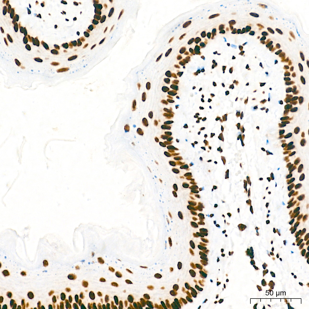TriMethyl-Histone H3-K4 Rabbit mAb
