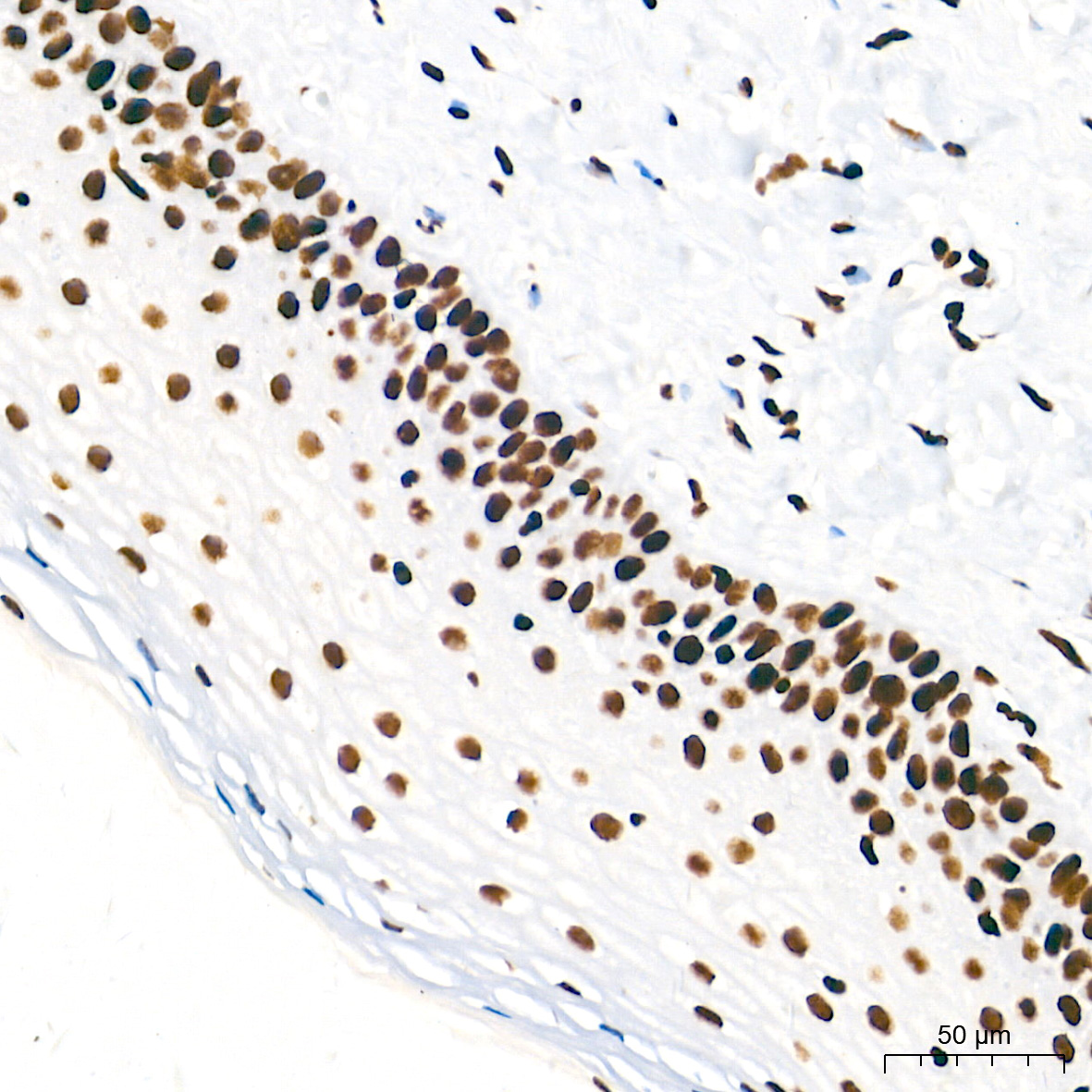 TriMethyl-Histone H3-K4 Rabbit mAb