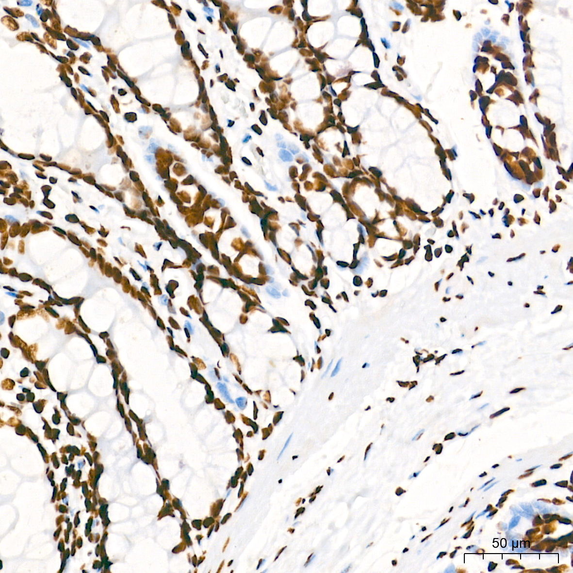 TriMethyl-Histone H3-K4 Rabbit mAb