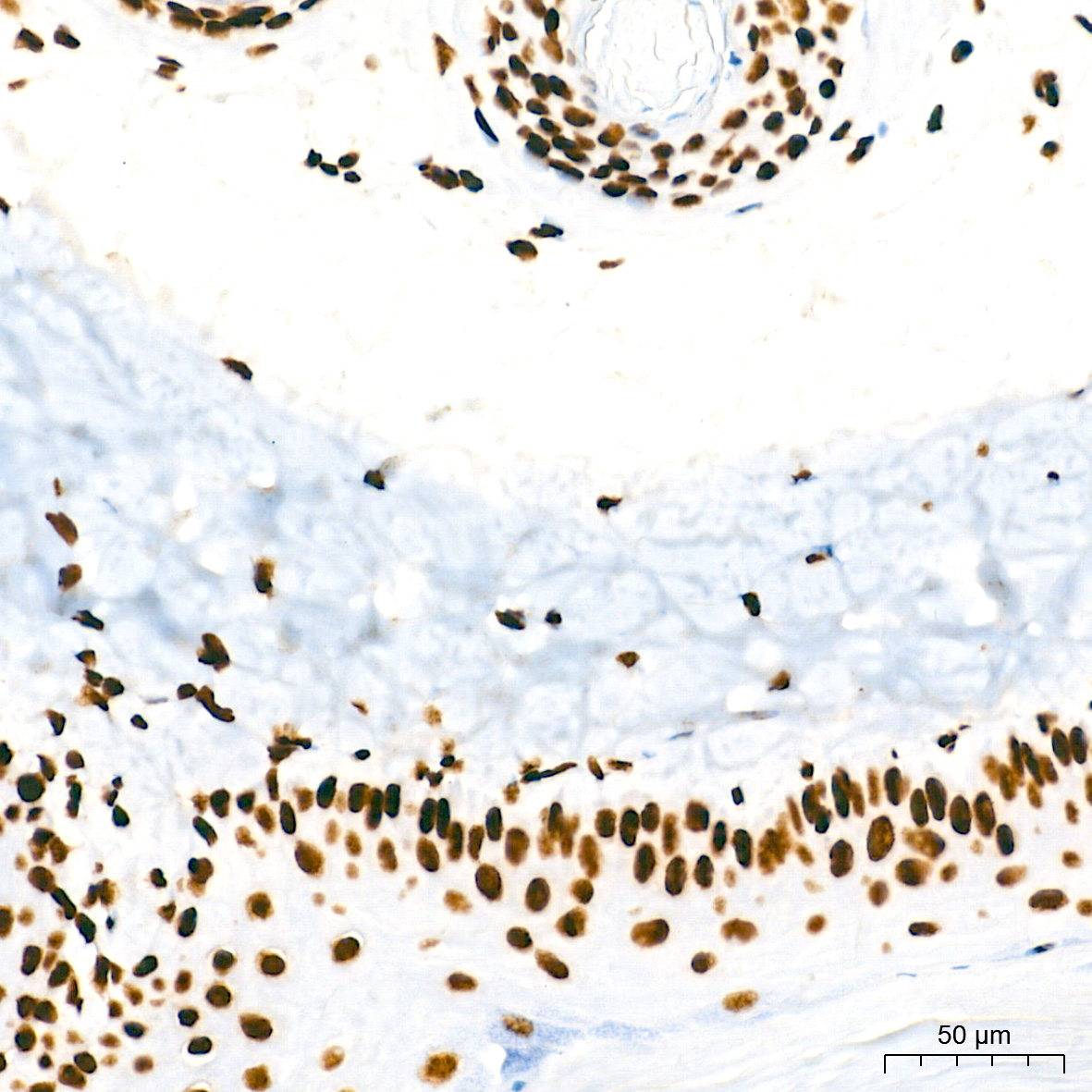 TriMethyl-Histone H3-K4 Rabbit mAb
