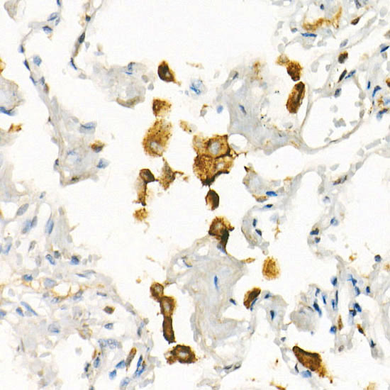CD71/Transferrin Receptor Rabbit mAb