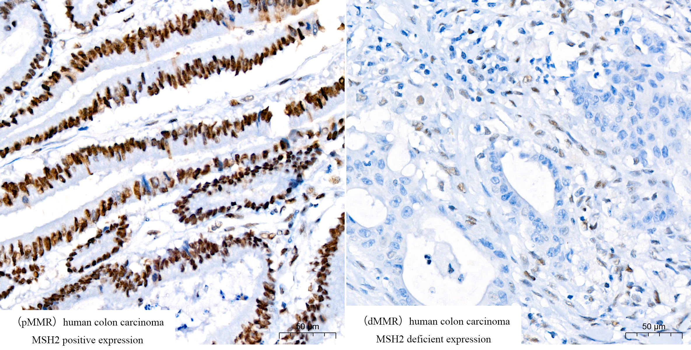 [KO Validated] MSH2 Rabbit mAb