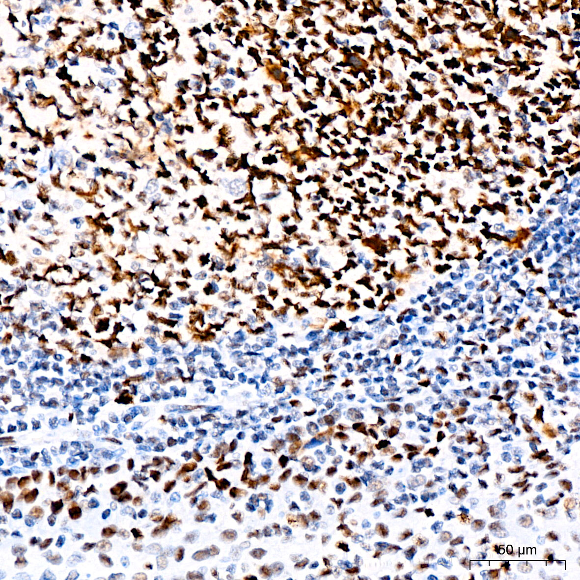[KO Validated] MSH2 Rabbit mAb