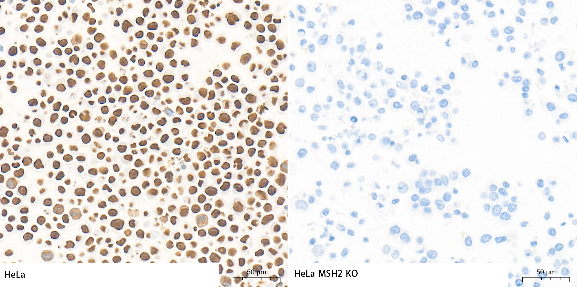 [KO Validated] MSH2 Rabbit mAb