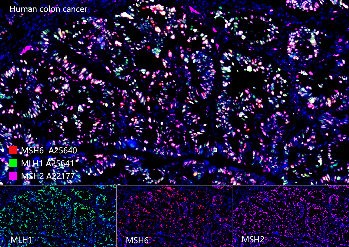 [KO Validated] MSH2 Rabbit mAb