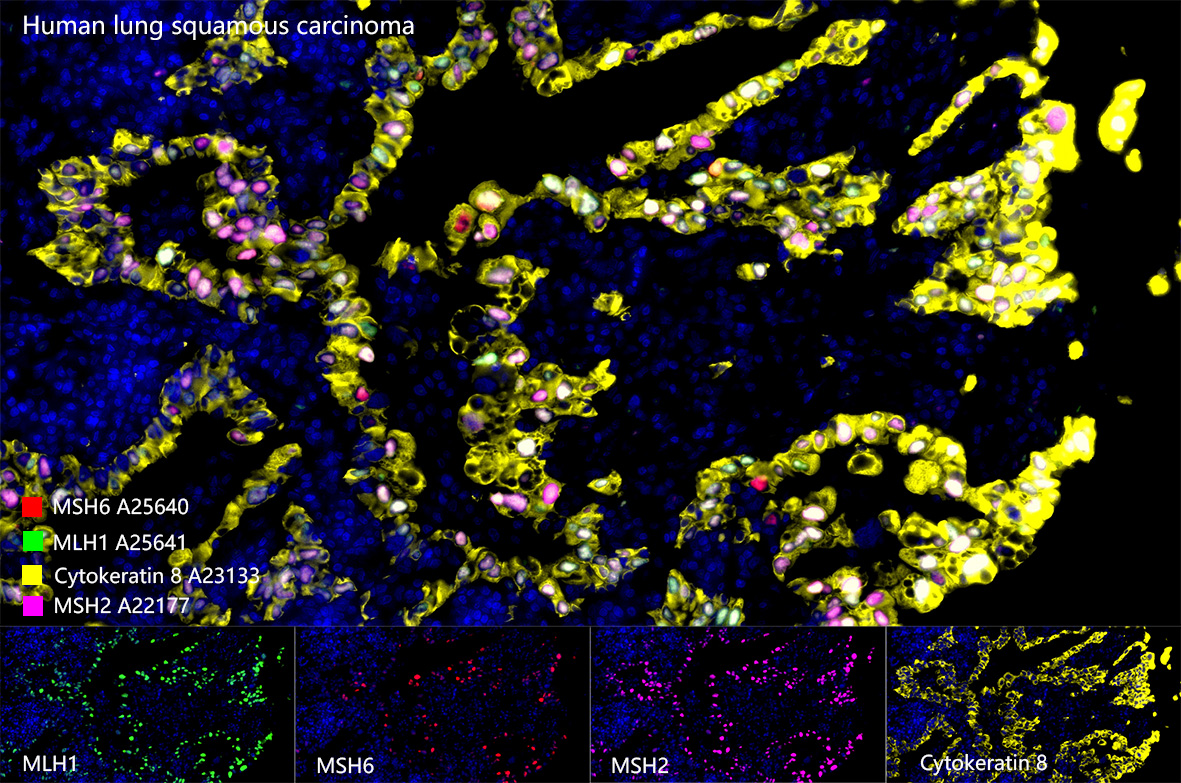 [KO Validated] MSH2 Rabbit mAb
