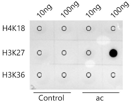 Acetyl-Histone H3-K27 Rabbit mAb