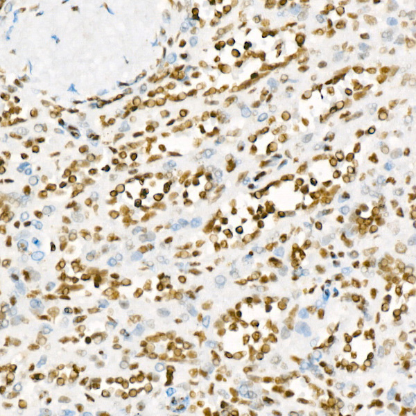 Acetyl-Histone H3-K27 Rabbit mAb