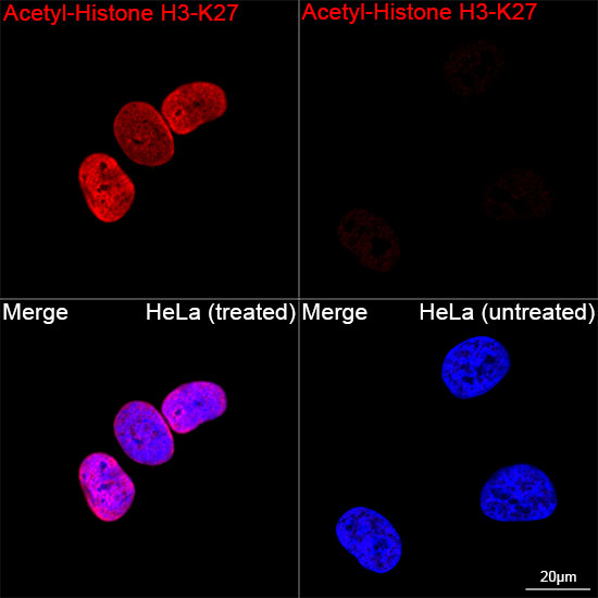 Acetyl-Histone H3-K27 Rabbit mAb