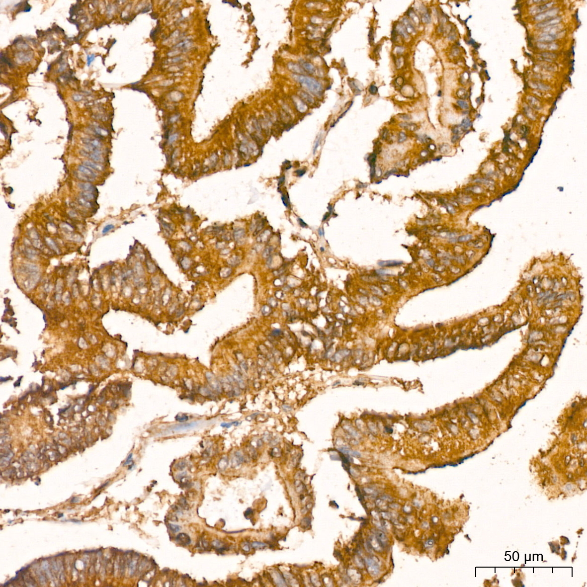 [KO Validated] NF-kB p65/RelA Rabbit mAb