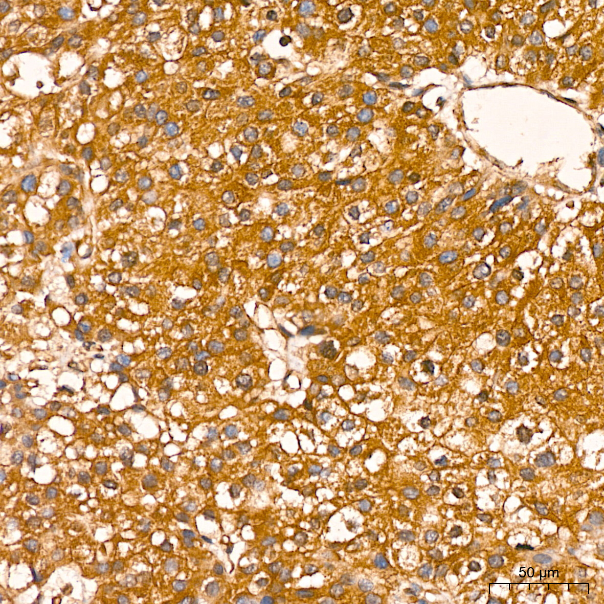 [KO Validated] NF-kB p65/RelA Rabbit mAb