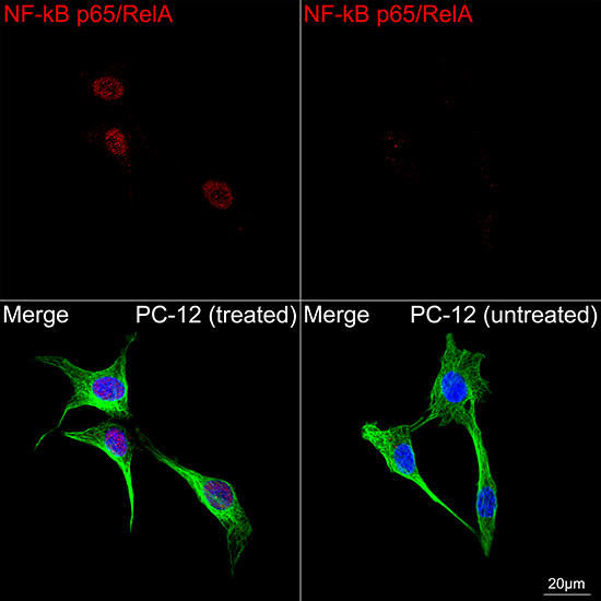 [KO Validated] NF-kB p65/RelA Rabbit mAb