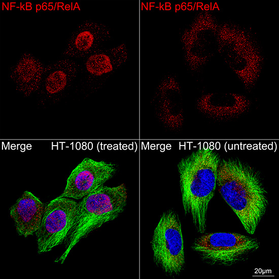 [KO Validated] NF-kB p65/RelA Rabbit mAb