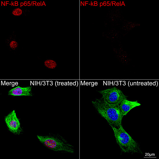 [KO Validated] NF-kB p65/RelA Rabbit mAb