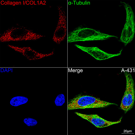 Collagen I/COL1A2 Rabbit mAb
