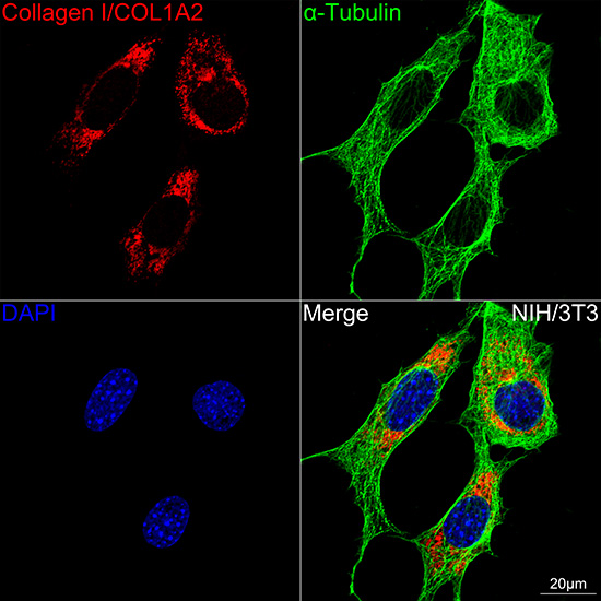 Collagen I/COL1A2 Rabbit mAb
