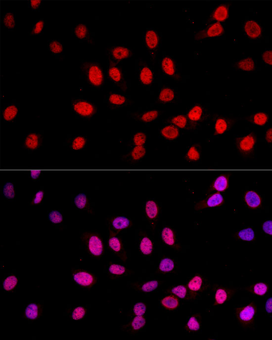 TriMethyl-Histone H3-K27 Rabbit mAb