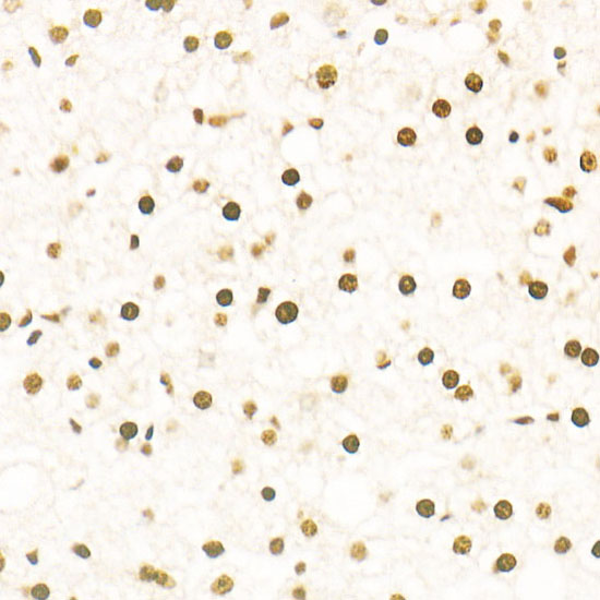 TriMethyl-Histone H3-K27 Rabbit mAb