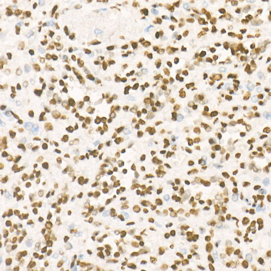 TriMethyl-Histone H3-K27 Rabbit mAb