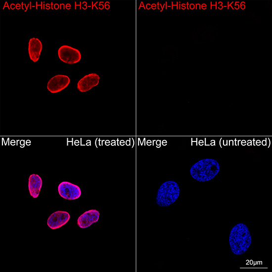 Acetyl-Histone H3-K56 Rabbit mAb