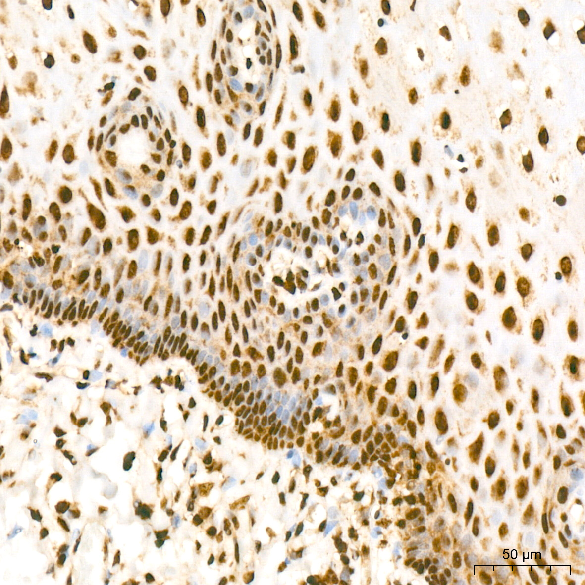 Acetyl-Histone H3-K56 Rabbit mAb