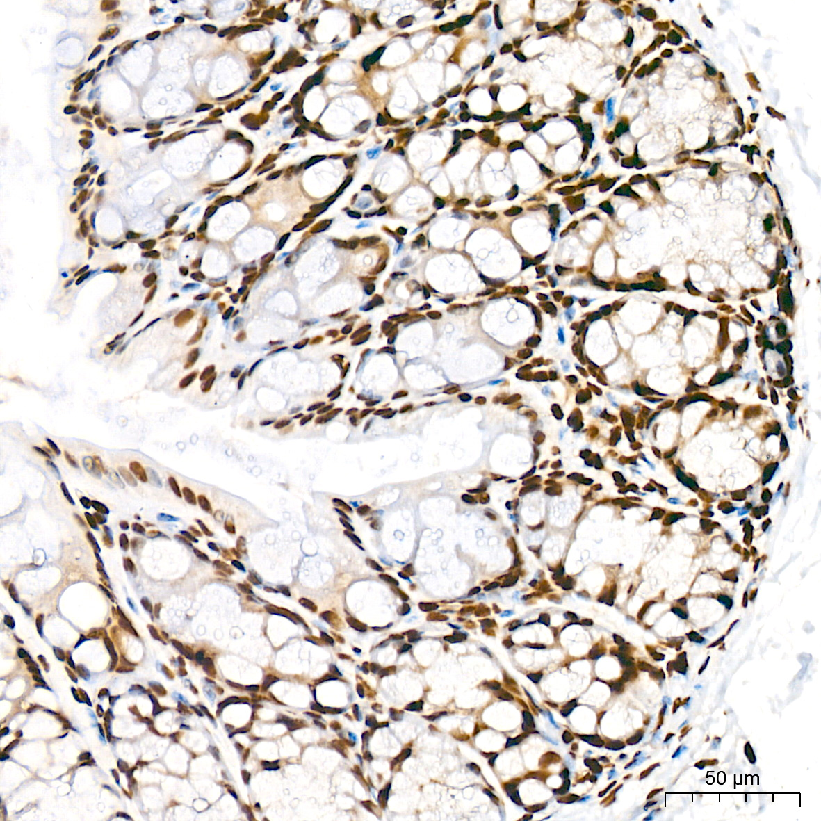 Acetyl-Histone H3-K56 Rabbit mAb