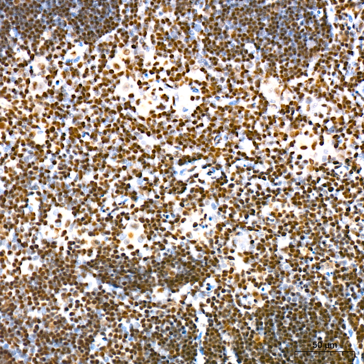 Acetyl-Histone H3-K56 Rabbit mAb