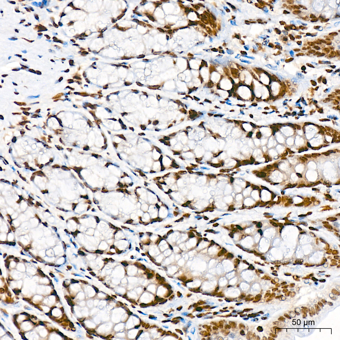 Acetyl-Histone H3-K56 Rabbit mAb