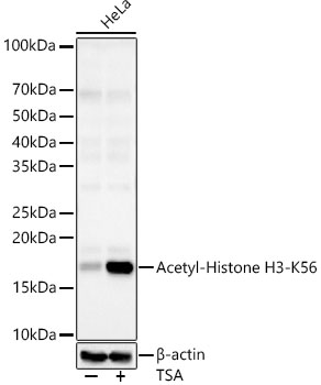 Acetyl-Histone H3-K56 Rabbit mAb