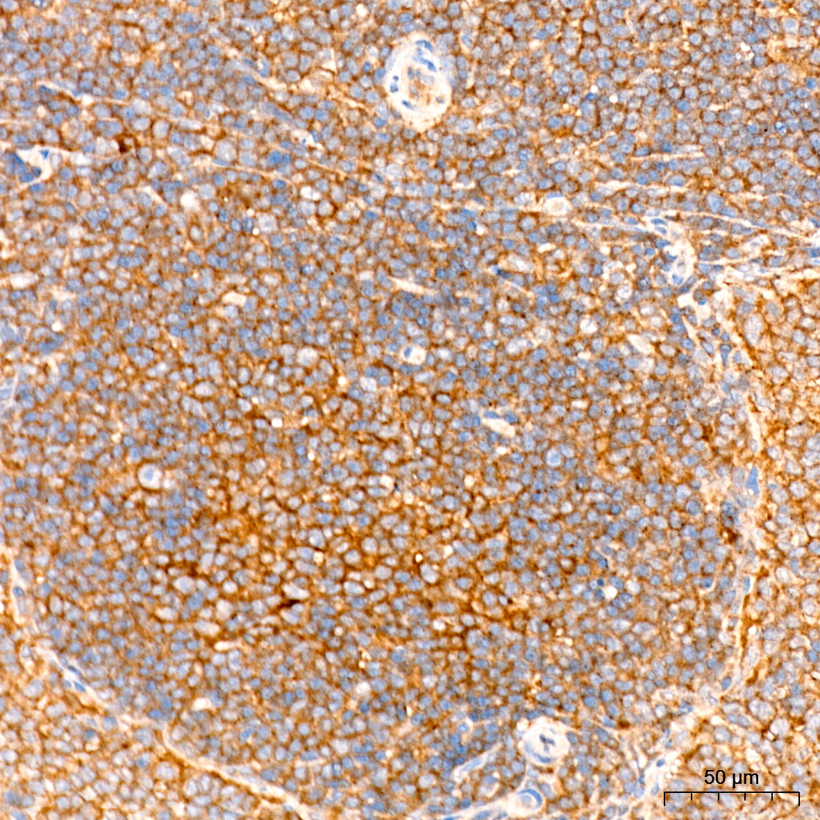 [KO Validated] LKB1 Rabbit mAb