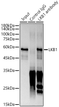 [KO Validated] LKB1 Rabbit mAb