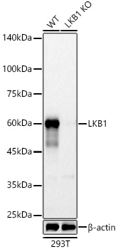 [KO Validated] LKB1 Rabbit mAb