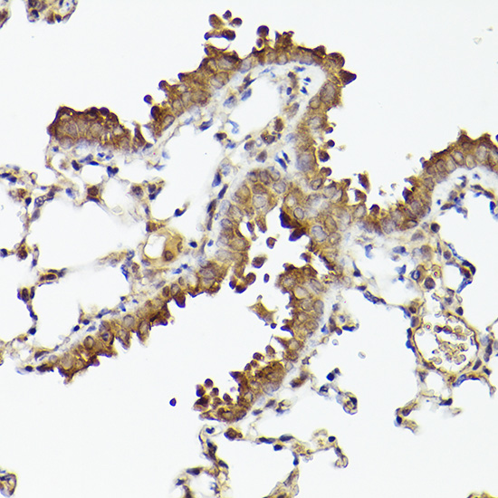 ATG12 Rabbit mAb