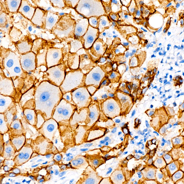 E-Cadherin Rabbit mAb