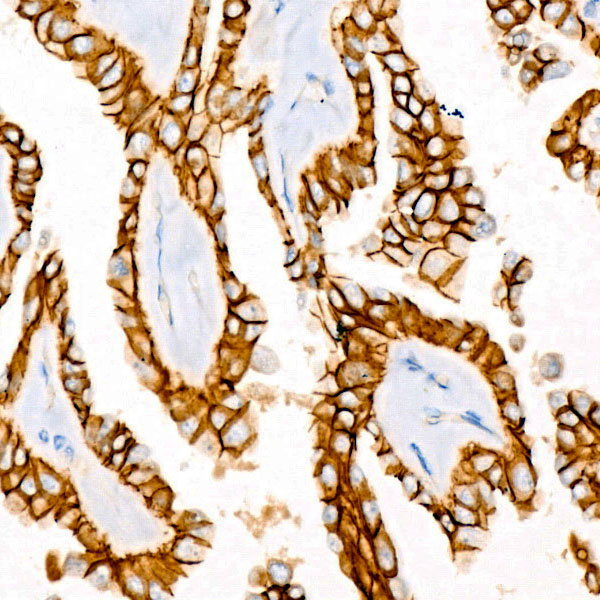 E-Cadherin Rabbit mAb