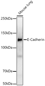 E-Cadherin Rabbit mAb