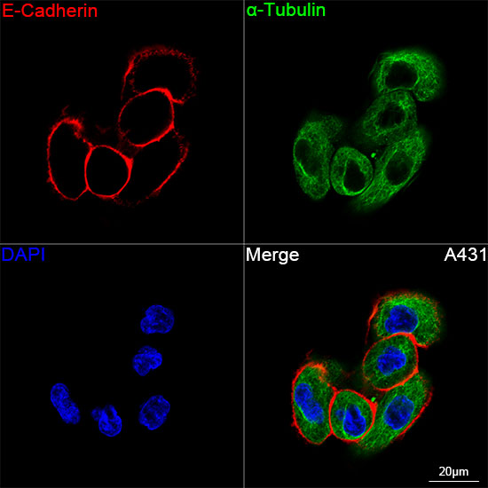 E-Cadherin Rabbit mAb