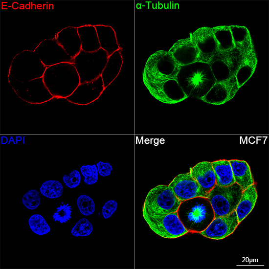E-Cadherin Rabbit mAb