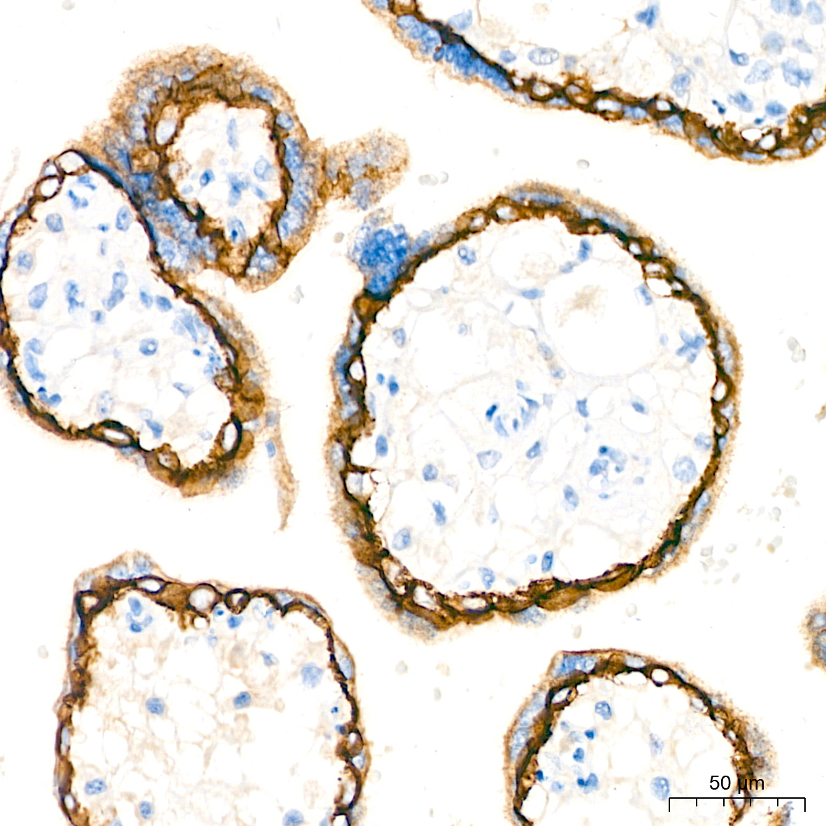 E-Cadherin Rabbit mAb