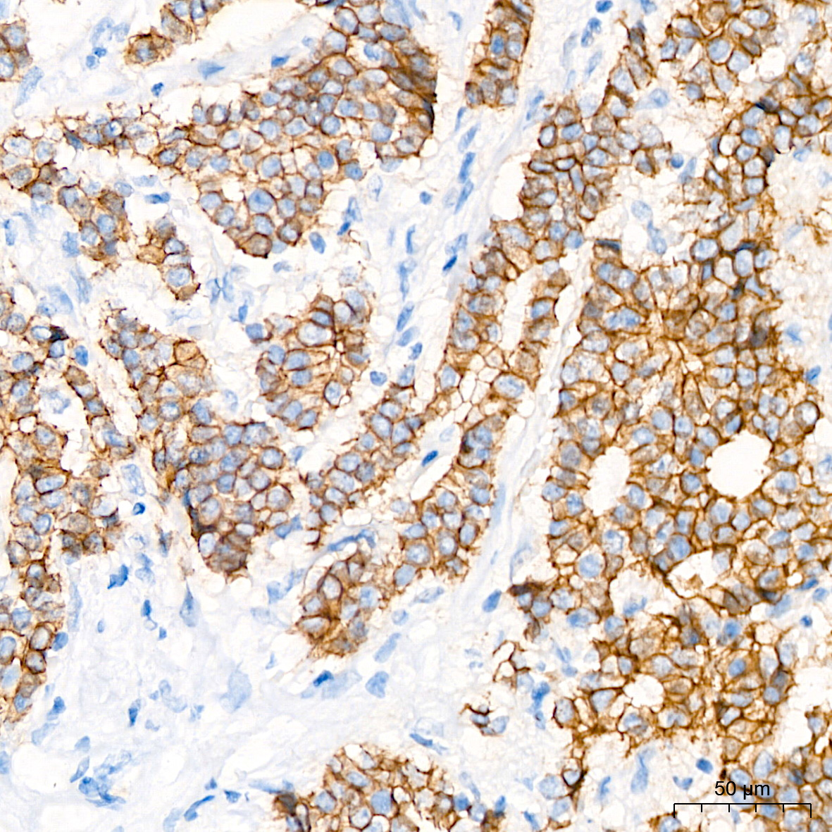 E-Cadherin Rabbit mAb