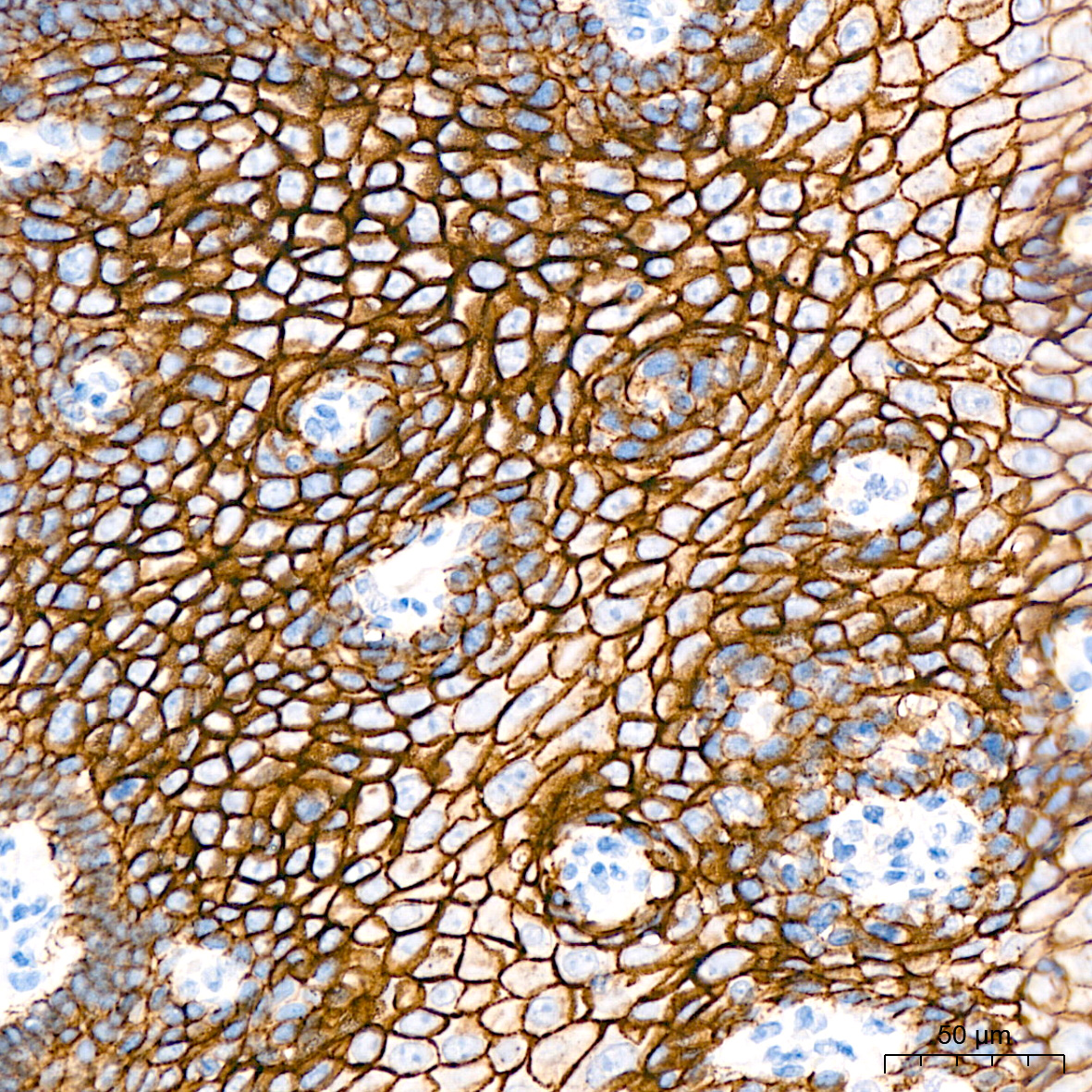 E-Cadherin Rabbit mAb